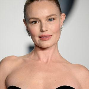 Kate Bosworth’s Heterochromia: The Mesmerizing Mismatched Eyes